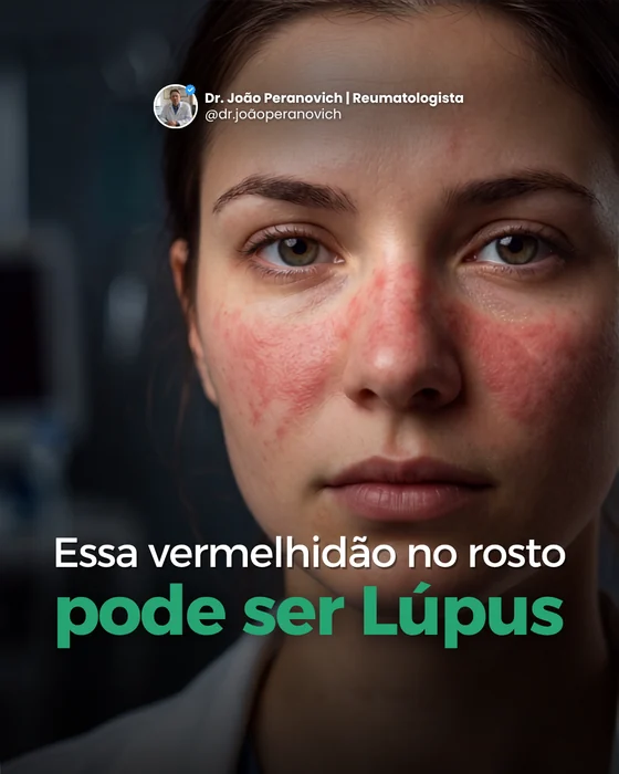 Saúde · post feed produzido pela Brota Web